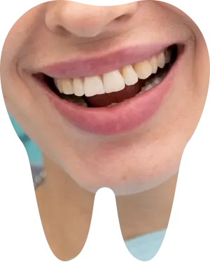 Confidence boost Smiling teeth icon showing confidence and self-esteem